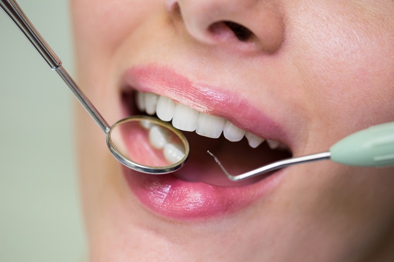 Tu stiai aceste lucruri despre tratamentul cu implant dentar?